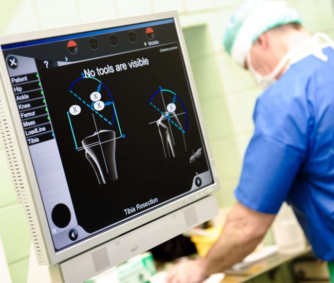 16872758 - medical orthopaedic equipment navigation system and surgeon on background at hospital